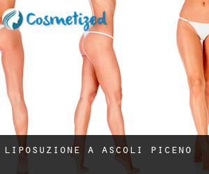 Liposuzione a Ascoli Piceno