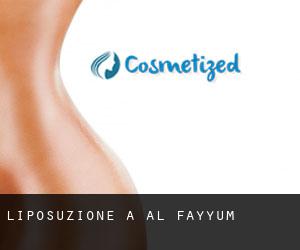 Liposuzione a Al Fayyūm