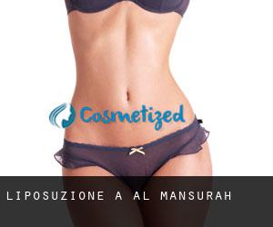 Liposuzione a Al Mansurah