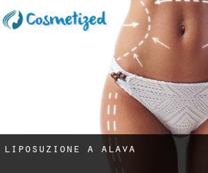 Liposuzione a Alava