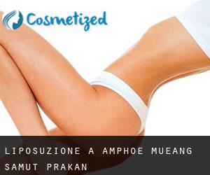 Liposuzione a Amphoe Mueang Samut Prakan Liposuzione a Amphoe Mueang Samut Prakan