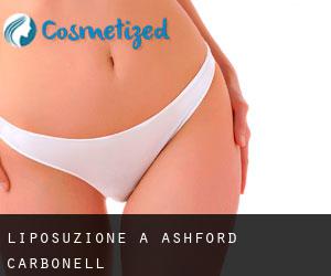 Liposuzione a Ashford Carbonell