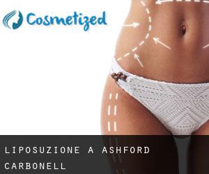 Liposuzione a Ashford Carbonell