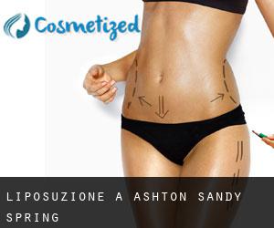 Liposuzione a Ashton-Sandy Spring