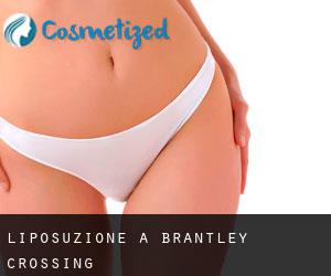Liposuzione a Brantley Crossing