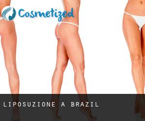 Liposuzione a Brazil