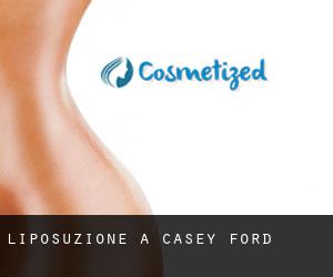 Liposuzione a Casey Ford