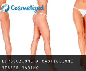 Liposuzione a Castiglione Messer Marino