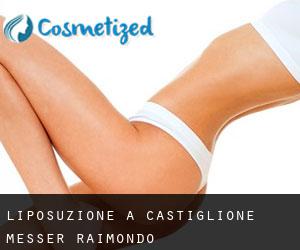 Liposuzione a Castiglione Messer Raimondo