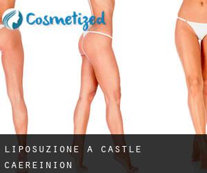 Liposuzione a Castle Caereinion