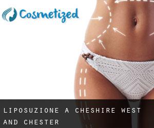 Liposuzione a Cheshire West and Chester