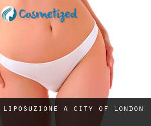 Liposuzione a City of London