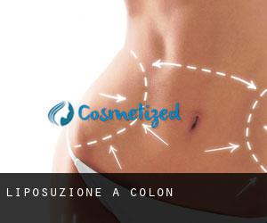 Liposuzione a Colón