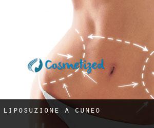 Liposuzione a Cuneo