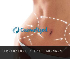 Liposuzione a East Bronson