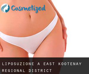 Liposuzione a East Kootenay Regional District