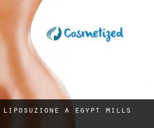 Liposuzione a Egypt Mills