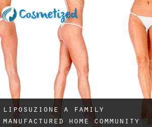 Liposuzione a Family Manufactured Home Community