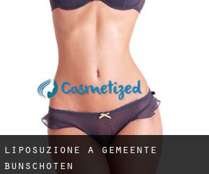 Liposuzione a Gemeente Bunschoten