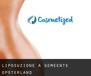 Liposuzione a Gemeente Opsterland