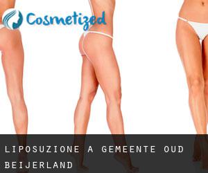 Liposuzione a Gemeente Oud-Beijerland