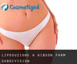Liposuzione a Gibson Farm Subdivision
