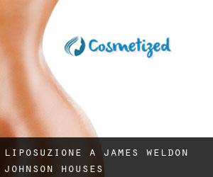 Liposuzione a James Weldon Johnson Houses
