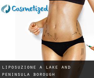 Liposuzione a Lake and Peninsula Borough Liposuzione a Lake and Peninsula Borough