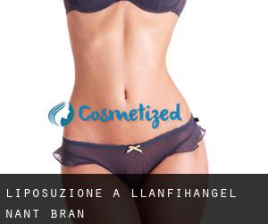 Liposuzione a Llanfihangel-Nant-Brân