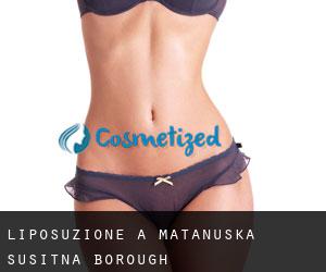 Liposuzione a Matanuska-Susitna Borough Liposuzione a Matanuska-Susitna Borough