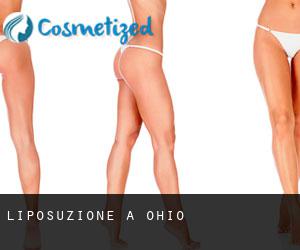 Liposuzione a Ohio