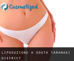 Liposuzione a South Taranaki District