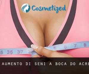 Aumento di seni a Boca do Acre Aumento di seni a Boca do Acre