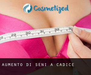 Aumento di seni a Cadice Aumento di seni a Cadice