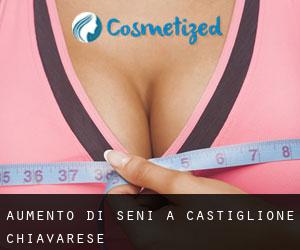Aumento di seni a Castiglione Chiavarese Aumento di seni a Castiglione Chiavarese