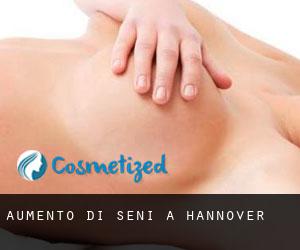Aumento di seni a Hannover Aumento di seni a Hannover
