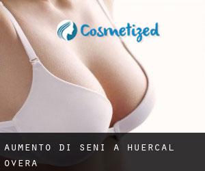 Aumento di seni a Huercal Overa Aumento di seni a Huercal Overa