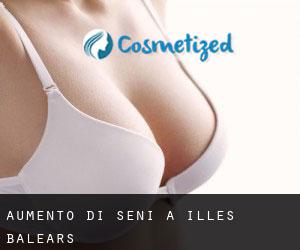 Aumento di seni a Illes Balears Aumento di seni a Illes Balears