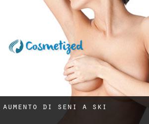 Aumento di seni a Şǝki Aumento di seni a Şǝki