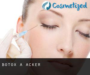 Botox a Acker