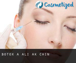 Botox a Ali Ak Chin