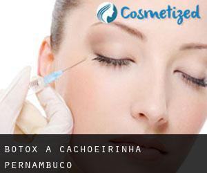 Botox a Cachoeirinha (Pernambuco)