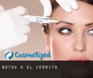 Botox a El Cerrito