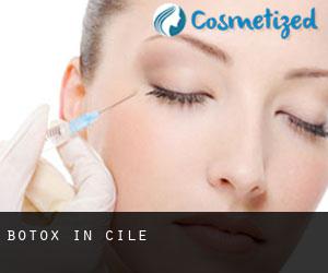 Botox in Cile Botox in Cile