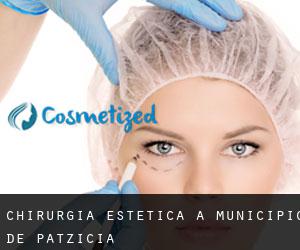 Chirurgia estetica a Municipio de Patzicía