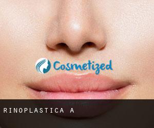 Rinoplastica a 연천군 Rinoplastica a 연천군