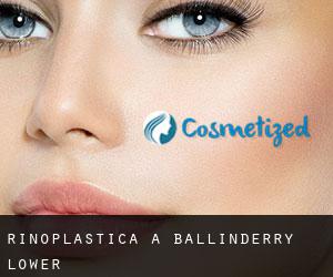 Rinoplastica a Ballinderry Lower Rinoplastica a Ballinderry Lower