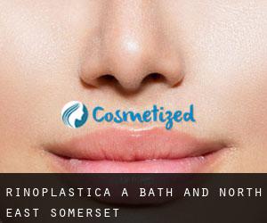 Rinoplastica a Bath and North East Somerset