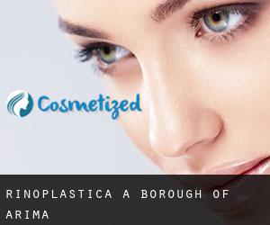Rinoplastica a Borough of Arima Rinoplastica a Borough of Arima