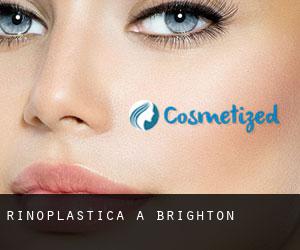 Rinoplastica a Brighton Rinoplastica a Brighton